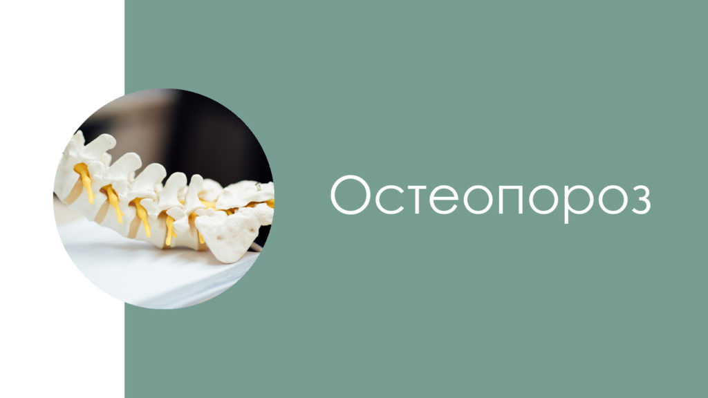 Остеопороз 2