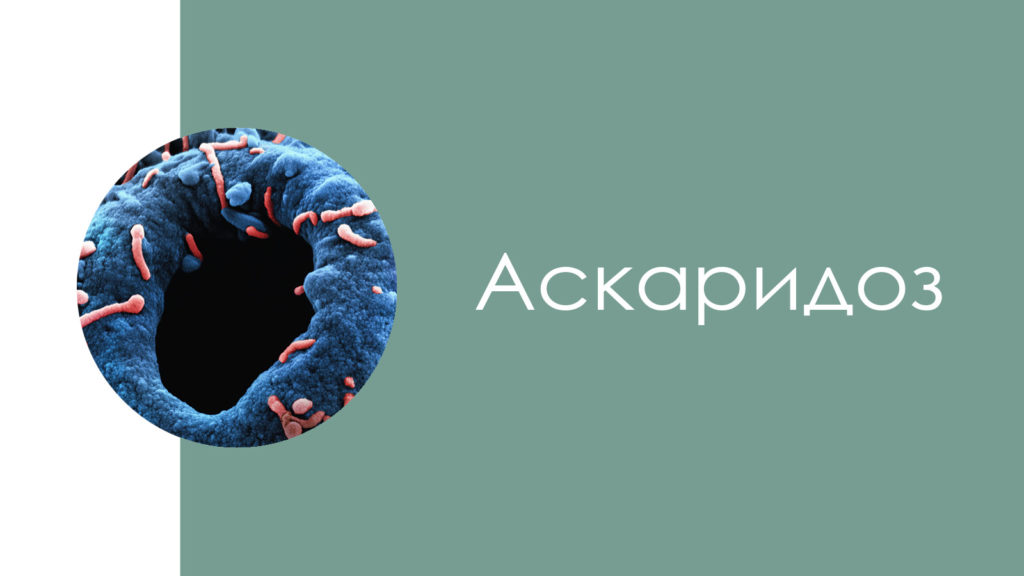 Аскаридоз2