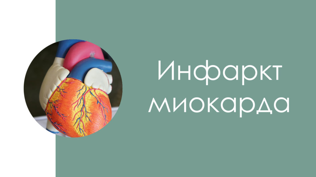 Инфаркт миокарда3