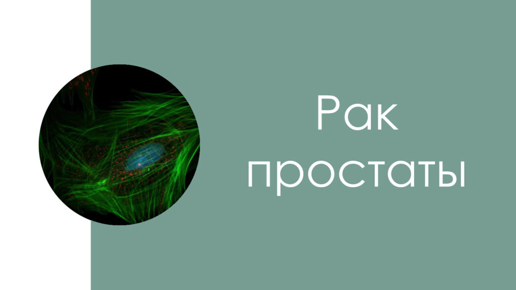 Рак простаты6