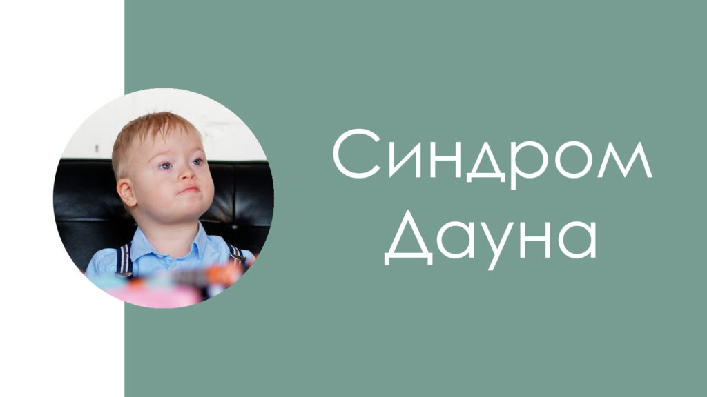 Синдром Дауна4