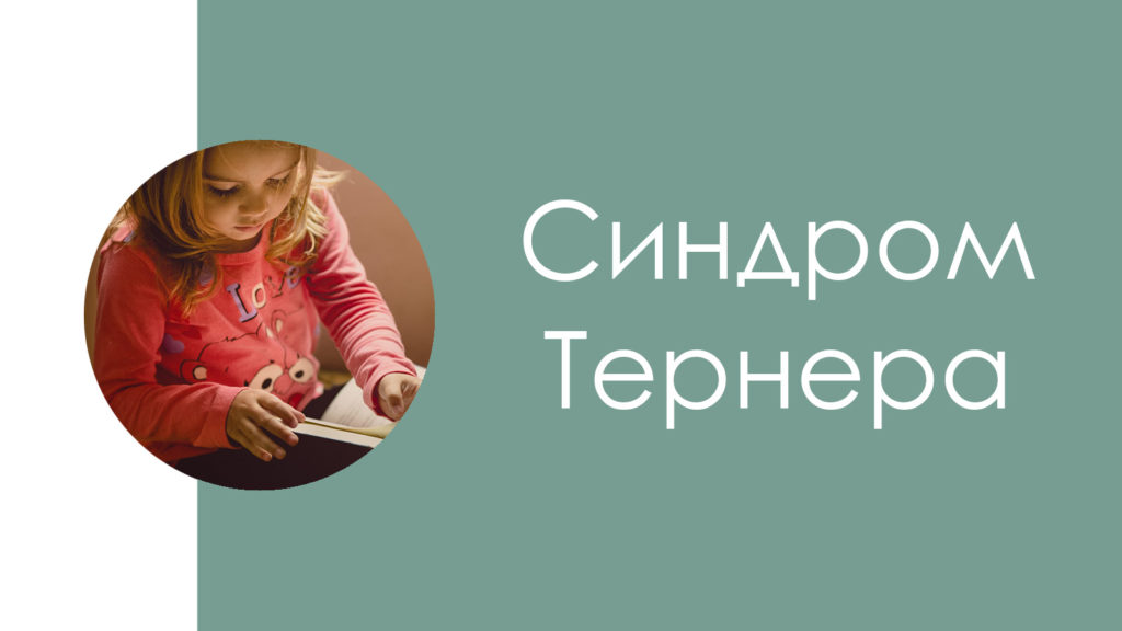 Синдром Тернера4