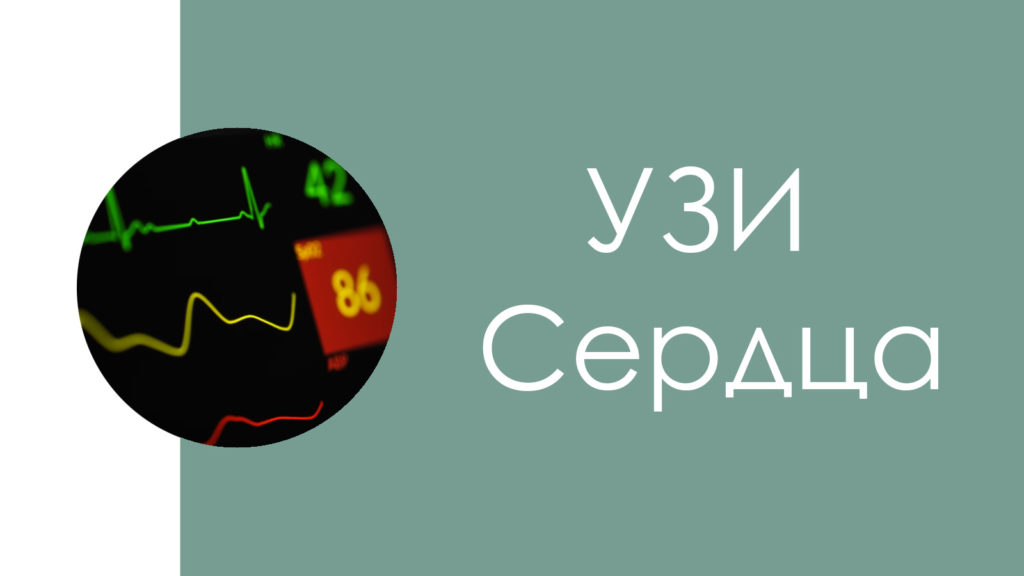 УЗИ сердца2